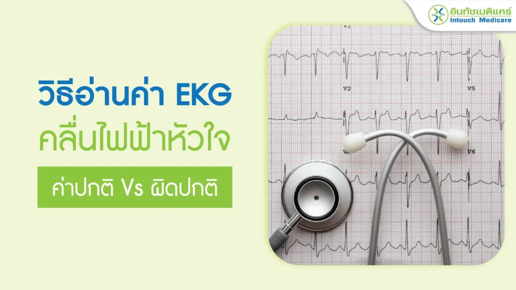 วิธีอ่านค่า EKG คลื่นไฟฟ้าหัวใจ ค่าปกติ vs ผิดปกติ