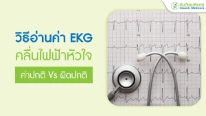วิธีอ่านค่า EKG คลื่นไฟฟ้าหัวใจ ค่าปกติ vs ผิดปกติ