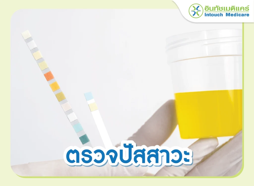 ตรวจปัสสาวะ เพื่อหาความผิดปกติของไต