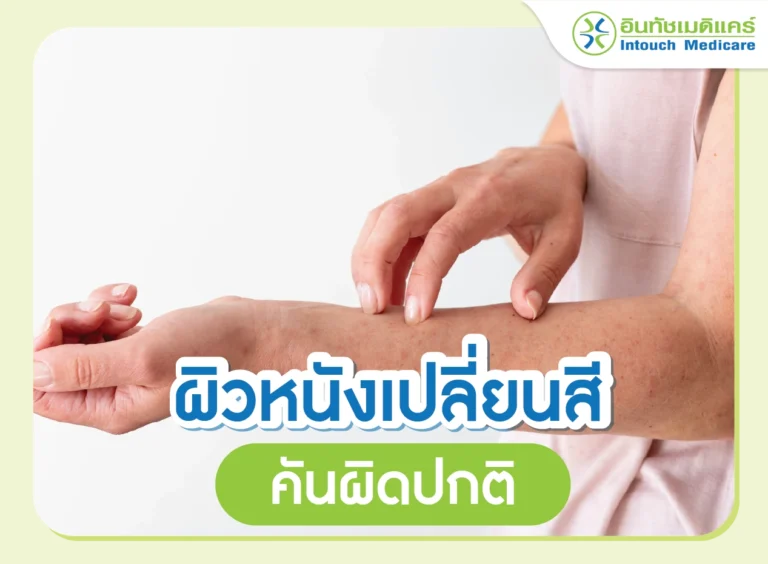ผิวหนังเปลี่ยนสี คันไม่ทราบสาเหตุ