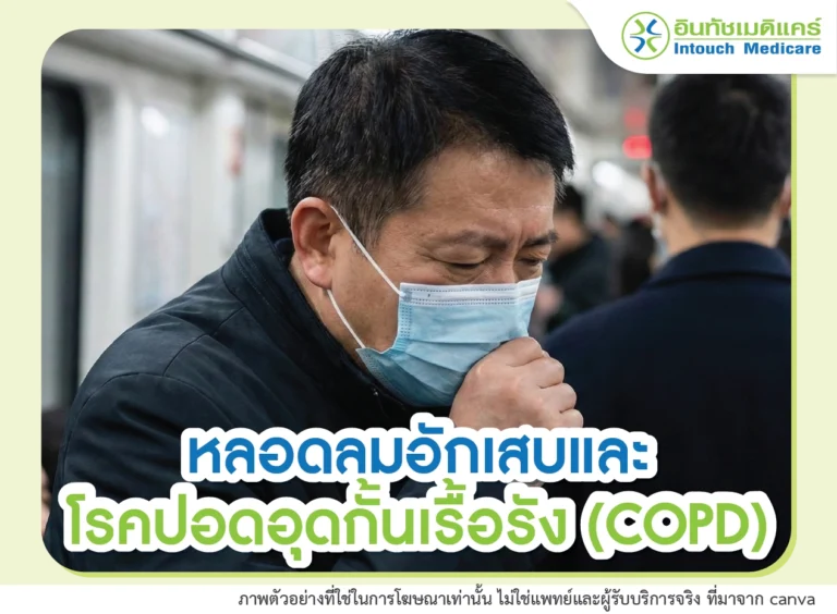 หลอดลมอักเสบ และโรคปอดอุดกั้นเรื้อรัง (COPD)