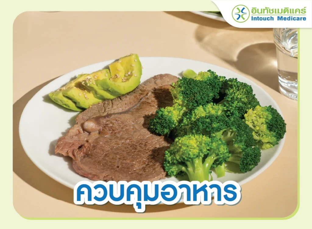 ควบคุมอาหาร