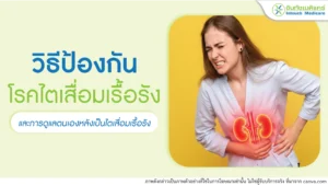 ธีป้องกันโรคไตเสื่อมเรื้อรัง และการดูแลตนเองหลังเป็นโรคไตเสื่อมเรื้อรัง
