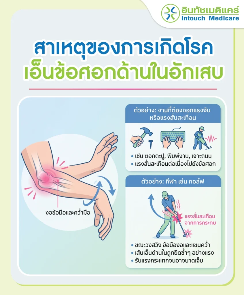 สาเหตุของการเกิดโรคโรคเอ็นข้อศอกด้านในอักเสบ
