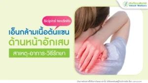 เอ็นกล้ามเนื้อต้นแขนด้านหน้าอักเสบ