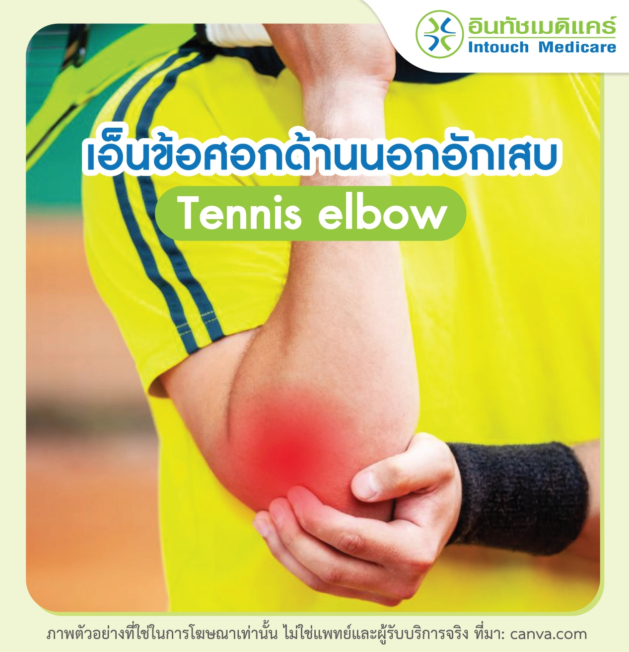 โรคเอ็นข้อศอกด้านนอกอักเสบคืออะไร