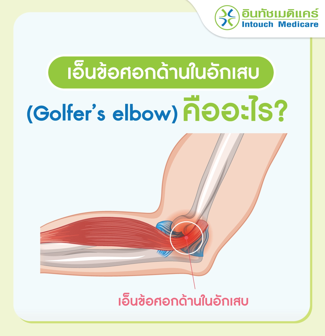 เอ็นข้อศอกด้านในอักเสบคืออะไร
