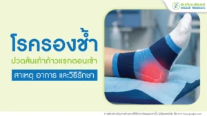 โรครองช้ำ Plantar fasciitis