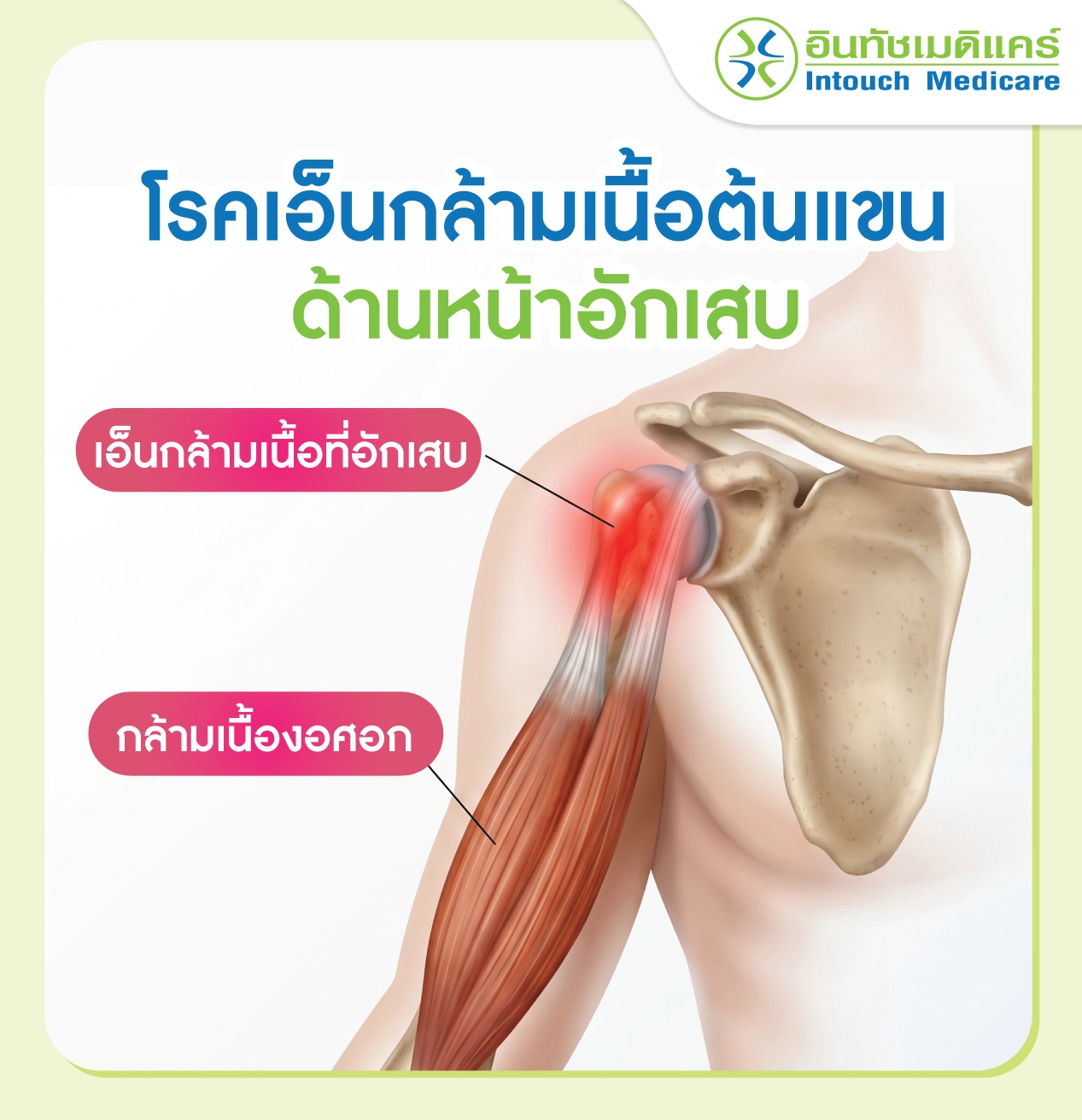 โรคเอ็นกล้ามเนื้อต้นแขนด้านหน้าอักเสบ