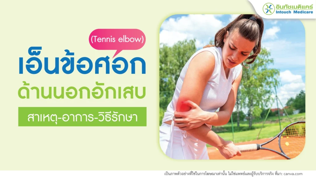 โรคเอ็นข้อศอกด้านนอกอักเสบ (Tennis elbow)