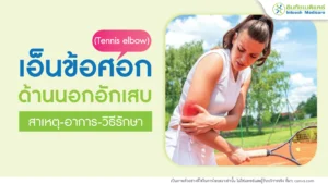 โรคเอ็นข้อศอกด้านนอกอักเสบ (Tennis elbow)