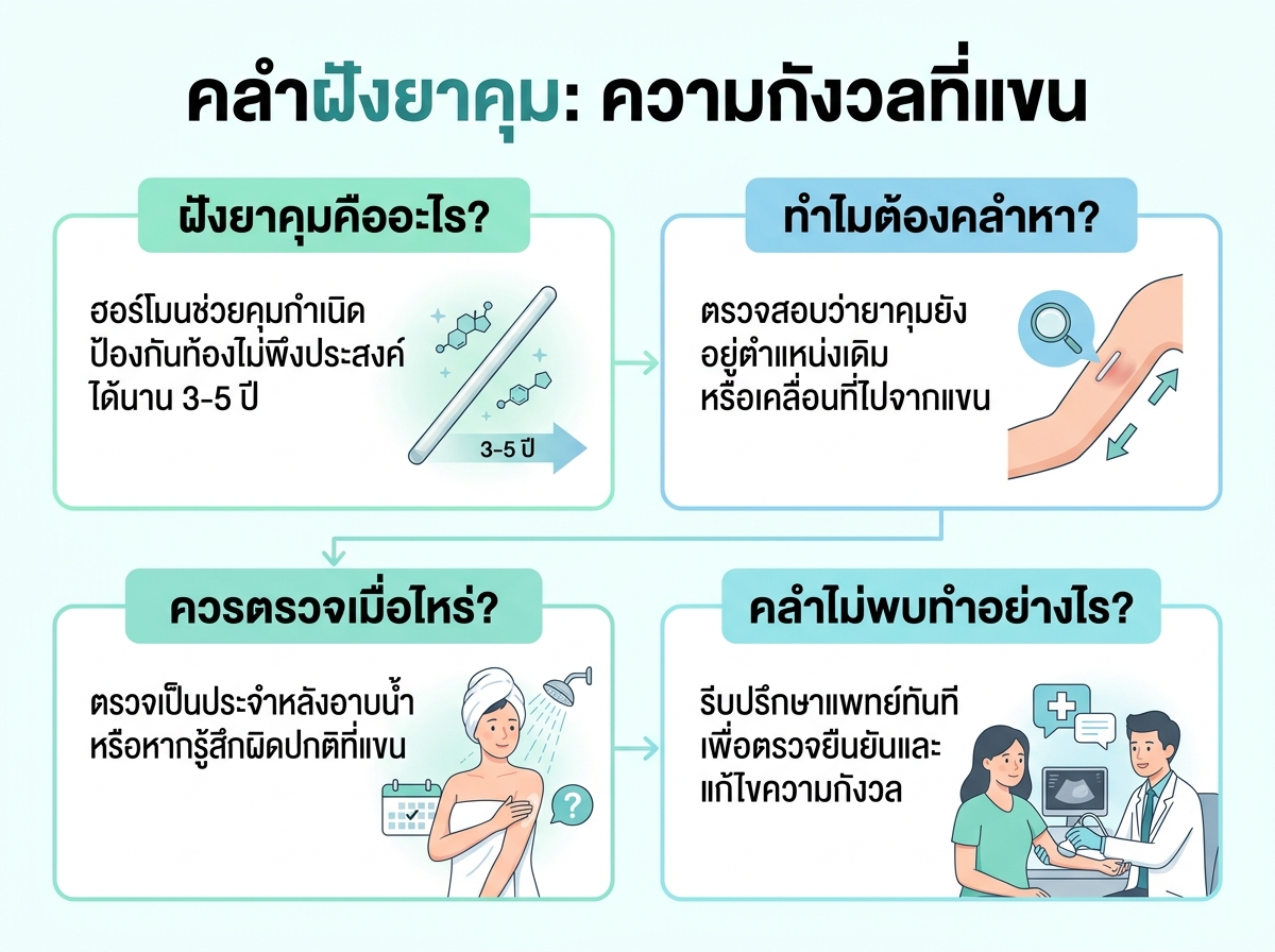 ผู้หญิงกำลังคลำหาก้านยาคุมที่แขนด้วยความกังวล