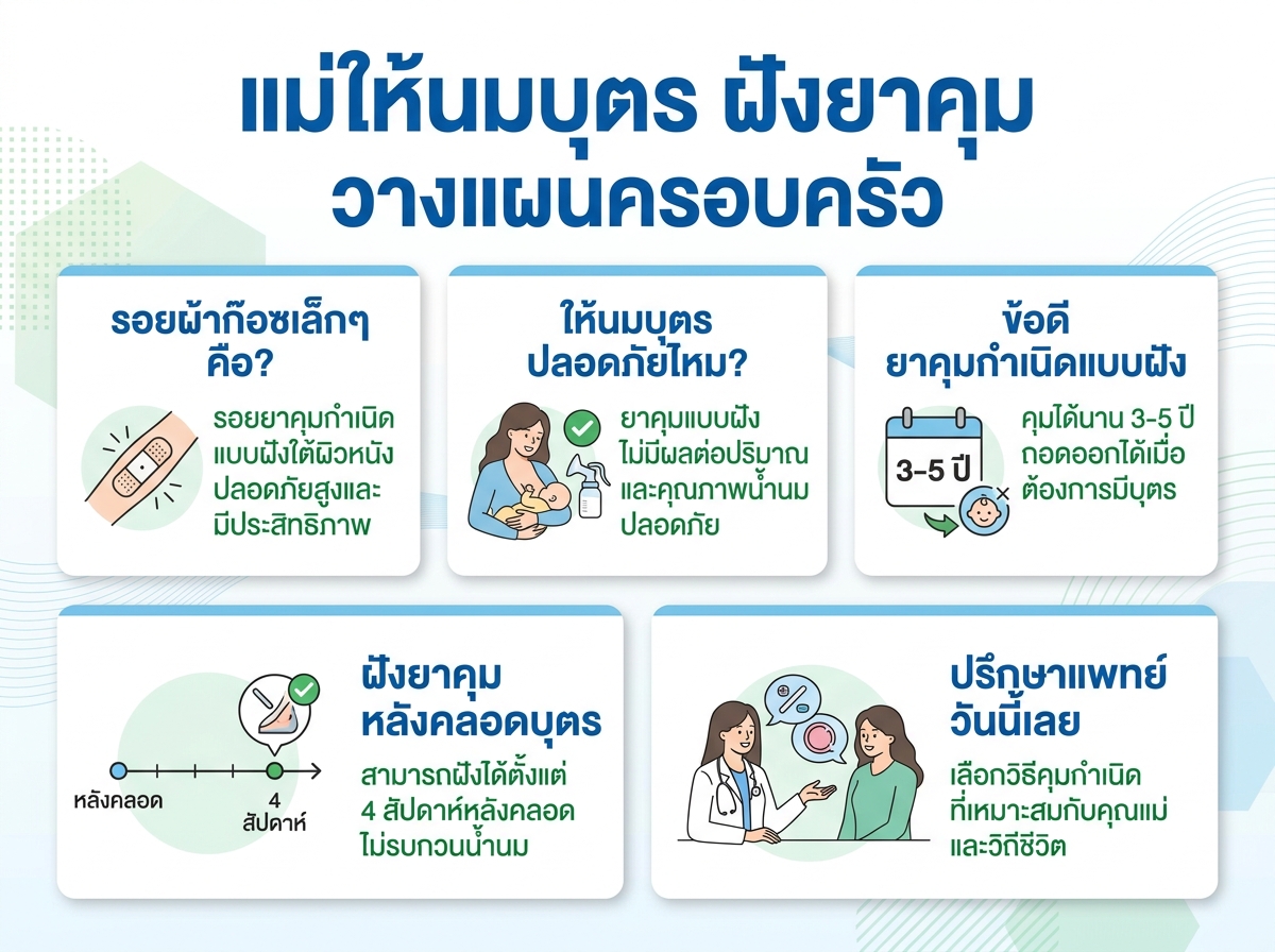 คุณแม่กำลังให้นมบุตรและมีรอยผ้าก๊อซเล็กๆ ที่แขน แสดงถึงการฝังยาคุมกำเนิด