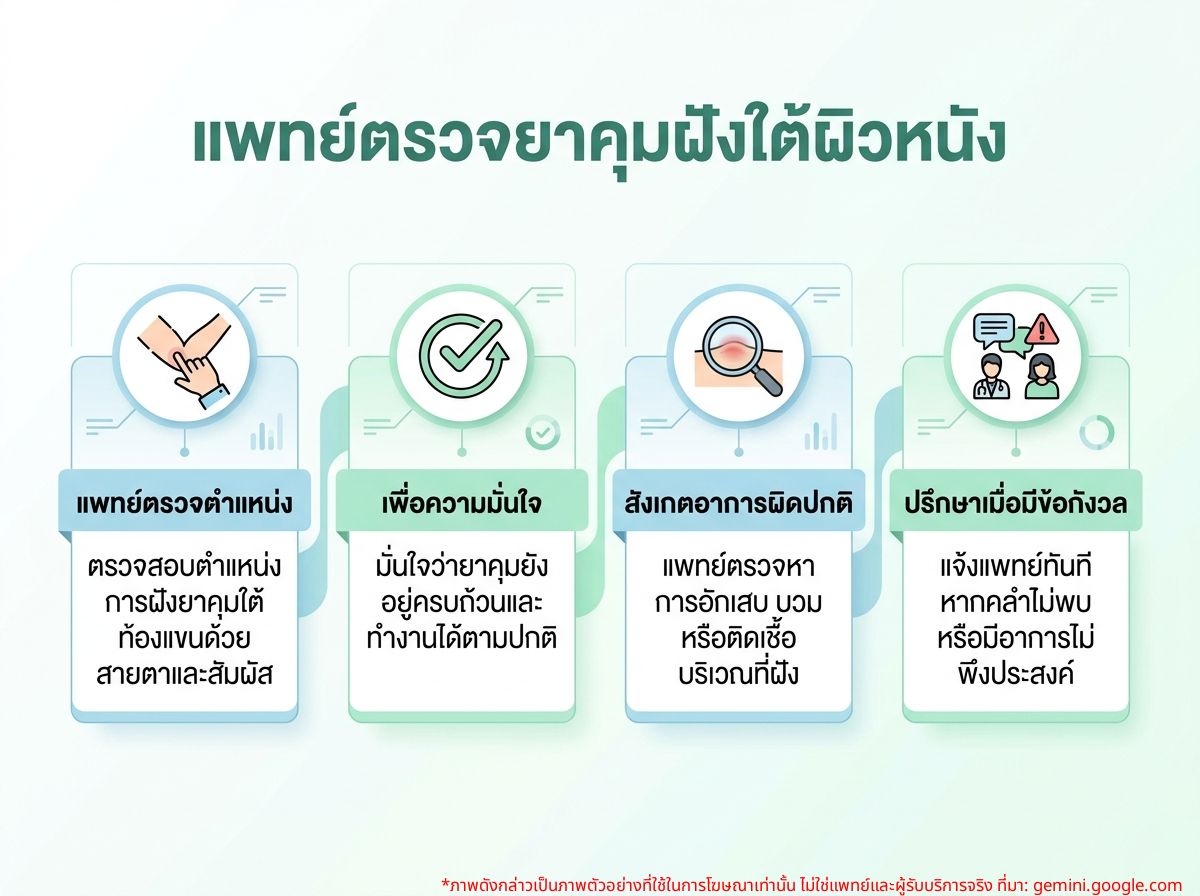 แพทย์กำลังตรวจการฝังยาคุมแบบฝัง