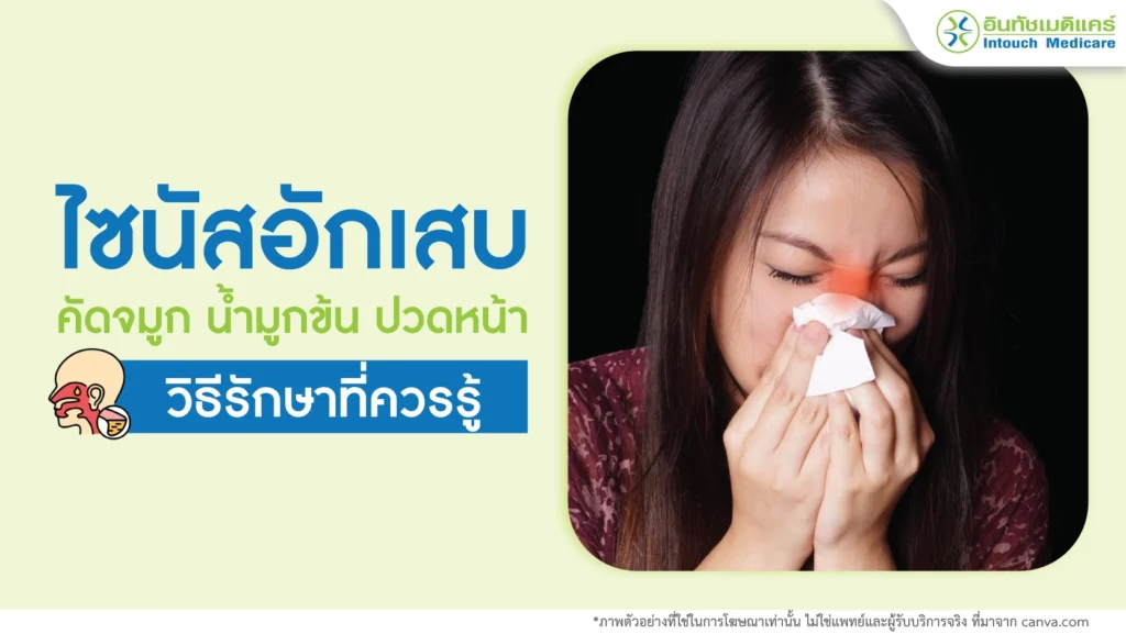 ไซนัสอักเสบ