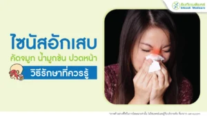 ไซนัสอักเสบ